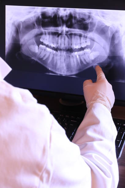 Best Root Canal Emergency Dentist  in Madison, NJ