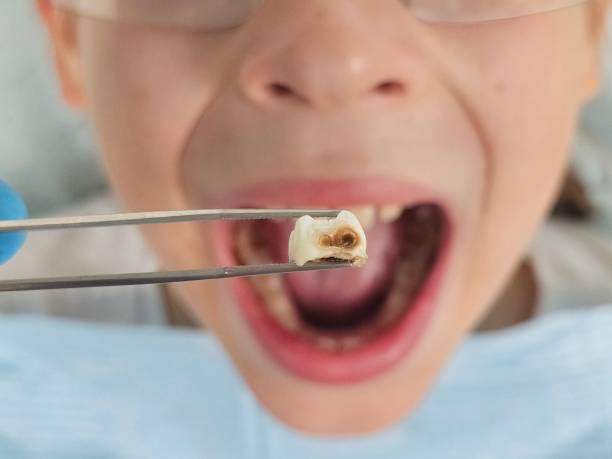 Best Knocked-Out Tooth Emergency  in Madison, NJ